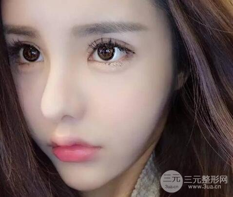 较好看的四种双眼皮