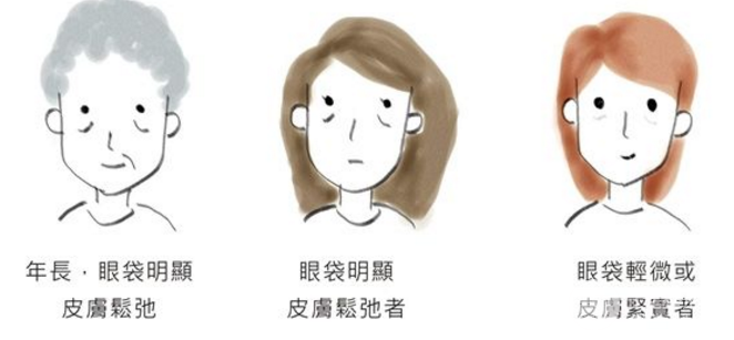 9个去眼袋的小妙招