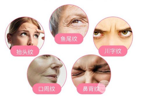 除鱼尾纹什么果好