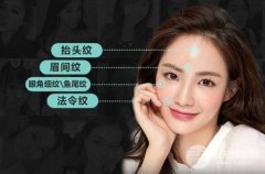 鱼纹注射除皱多久打一次？能注射哪种材料?