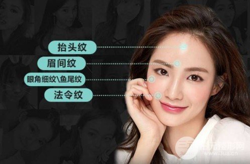 鱼纹注射除皱多久打一次