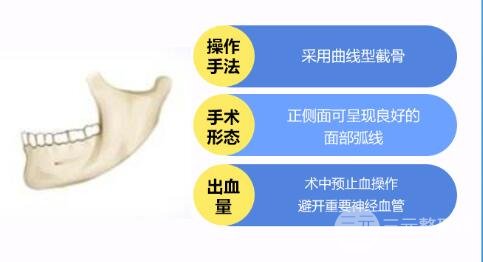 磨下颌角手术价格