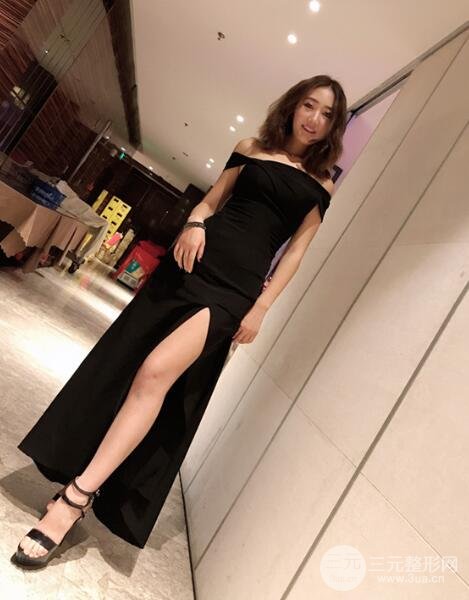 美联臣医院抽脂案例
