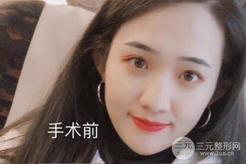 觉得自己的眼睛较为小