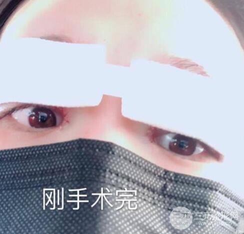 觉得自己的眼睛较为小