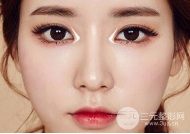 为什么医生建议开眼角?