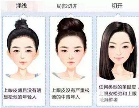 做埋线后老了的危害
