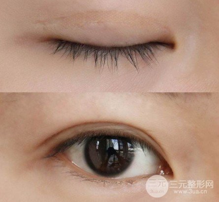 怎样让眼睛变大变萌