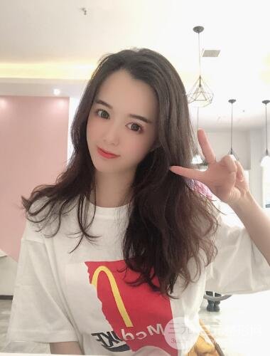 脂肪填充太阳穴恢复期