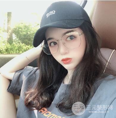 脂肪填充太阳穴恢复期