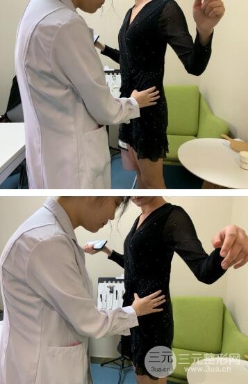 腰腹吸脂手术后