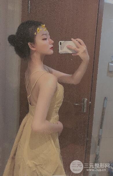 腰腹吸脂手术后