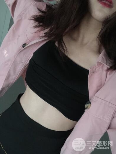 腰腹吸脂手术后