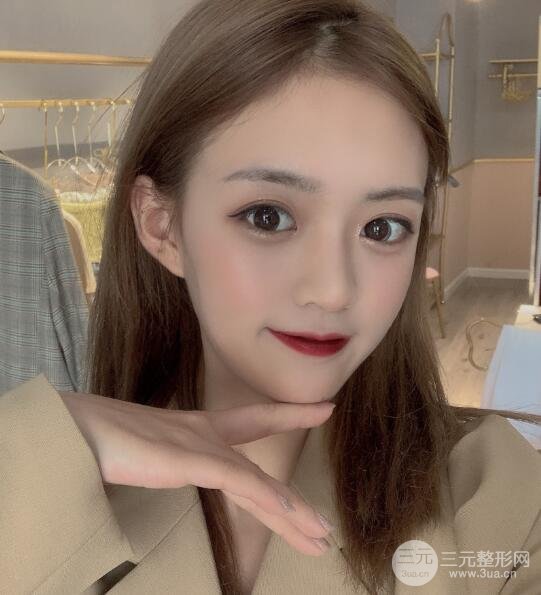 长春中妍整形案例