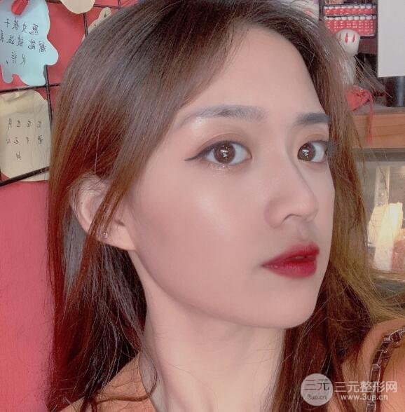 长春中妍整形案例