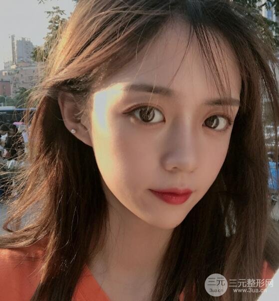 长春中妍整形案例
