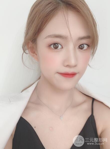 长春中妍整形案例