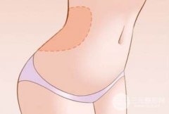 腰腹部环吸几天能走路? 除了静养还要做什么?