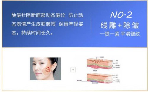 面部轮廓提升针是用什么打的