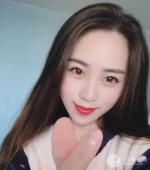 自体脂肪填充太阳穴凹陷案例