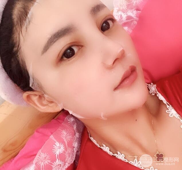 开外眼角手术后