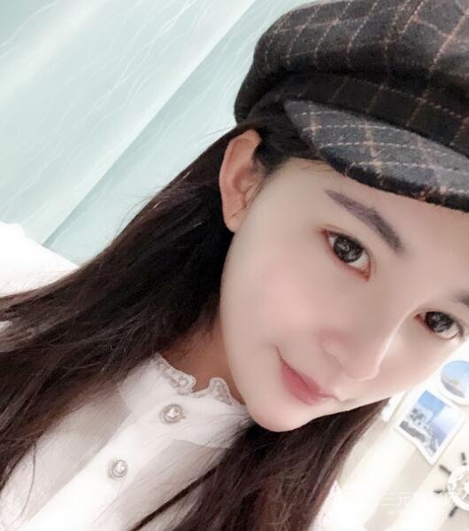 开外眼角手术后