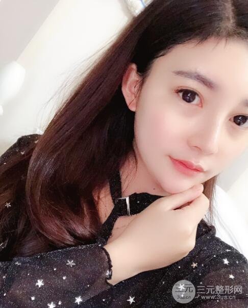 开外眼角手术后