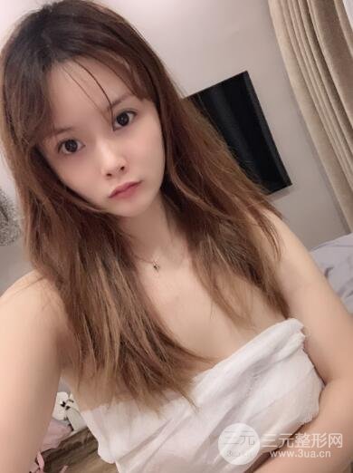 丰胸整形前: