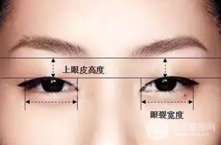 欧式眼与芭比眼的区别