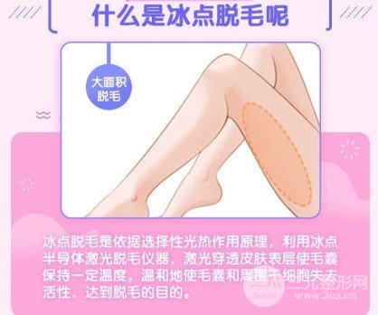 冰点脱毛维持时间