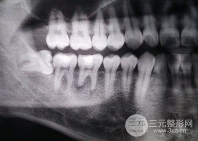 长春拜博口腔案例