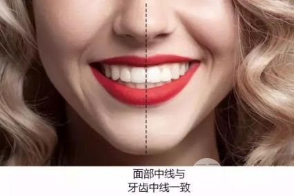 北大口腔医院讲解牙齿美白