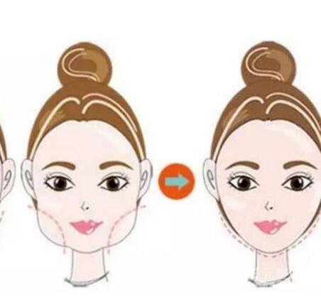 什么是微创改脸型