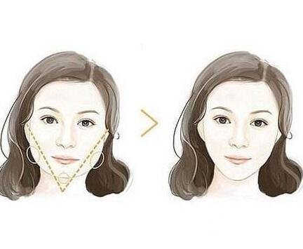 什么是微创改脸型