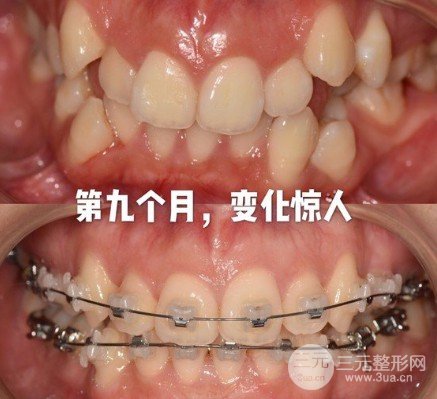 拜伦口腔医院收费标准
