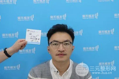 植发的价钱大概多少
