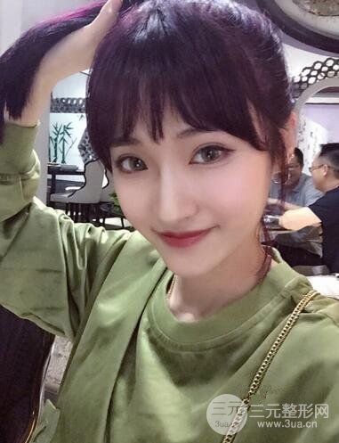 阜阳眼部整形案例反馈