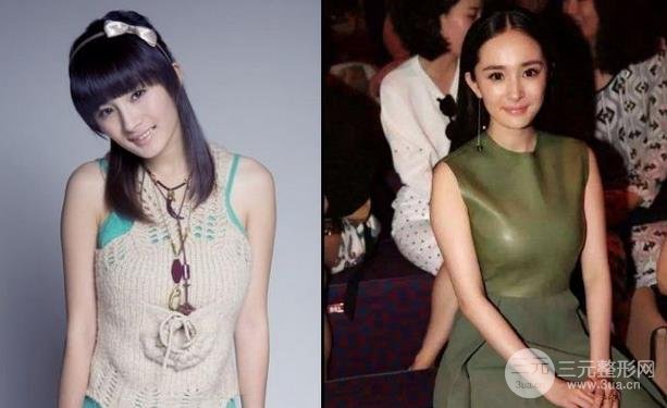 揭秘#杨幂隆胸照对比照片,从a到g的胸部进化史