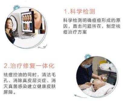 光子祛痘印多少钱一次