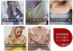 假体隆胸方法靠谱吗？可能有哪些并发症?