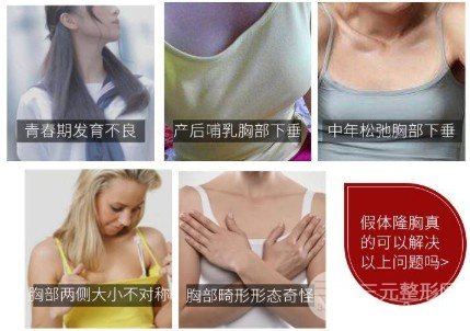 假体隆胸靠谱吗