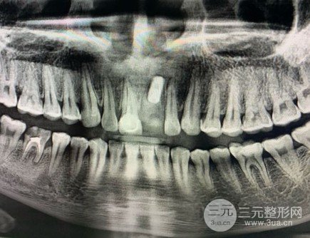 金沙洲健业牙科收费标准