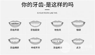 牙齿矫正科普