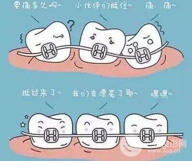 牙齿矫正科普