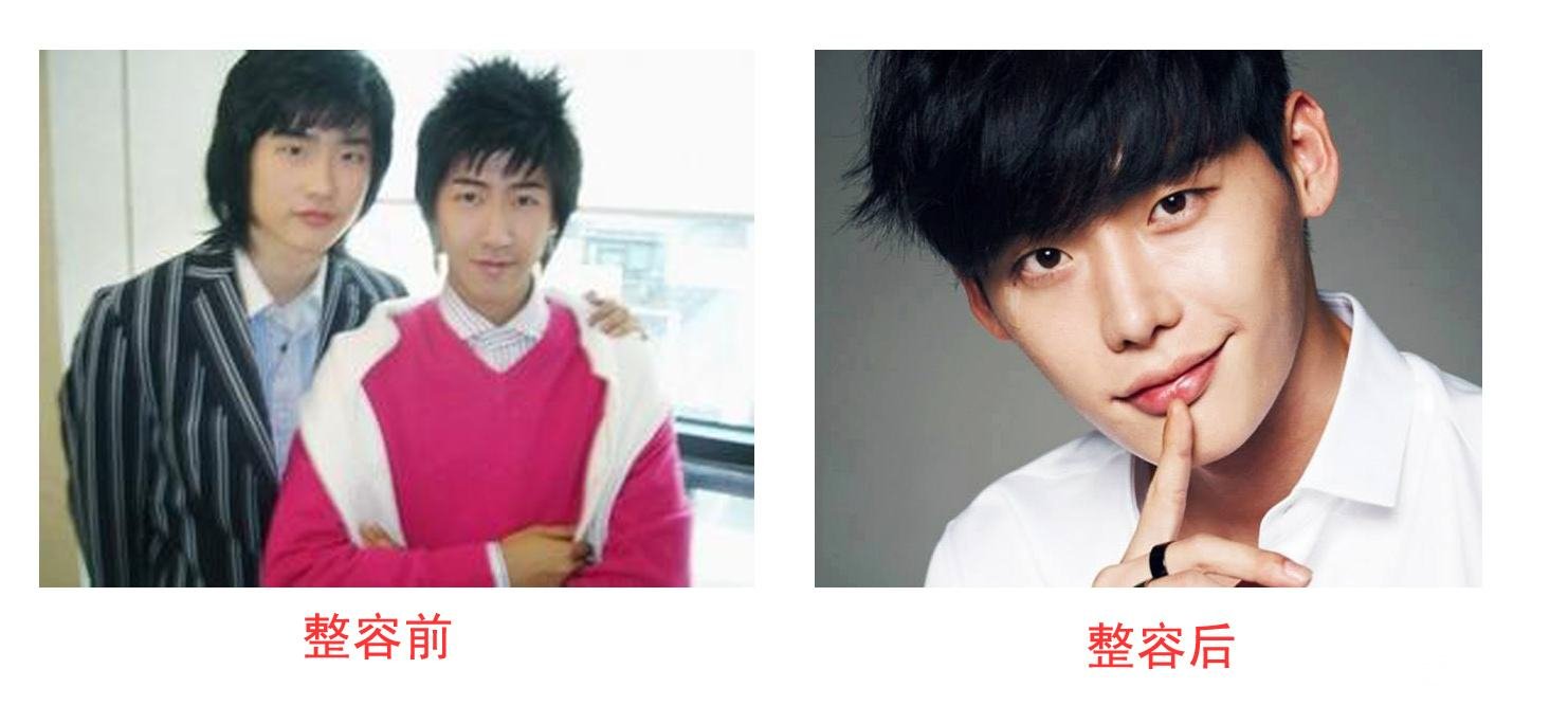 李钟硕整容前后照片