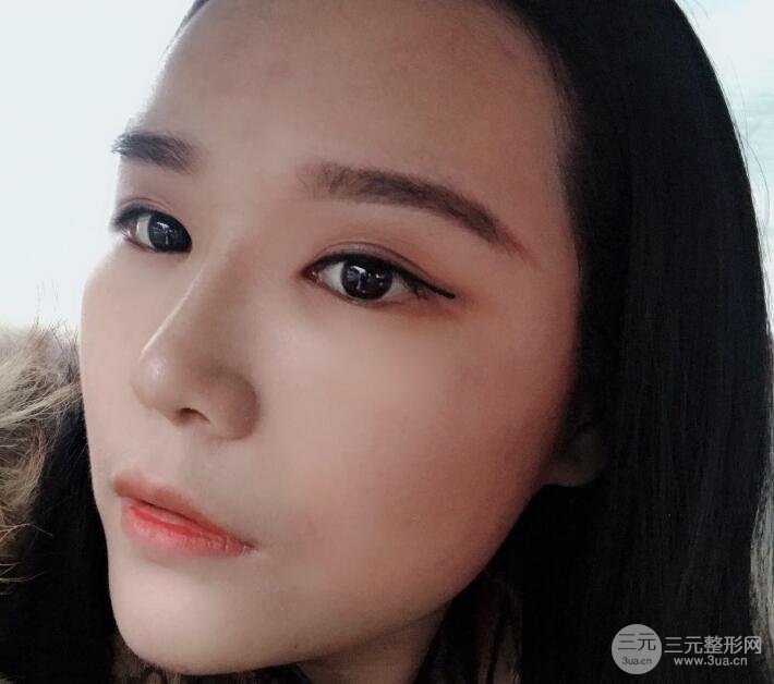 丰太阳穴手术中