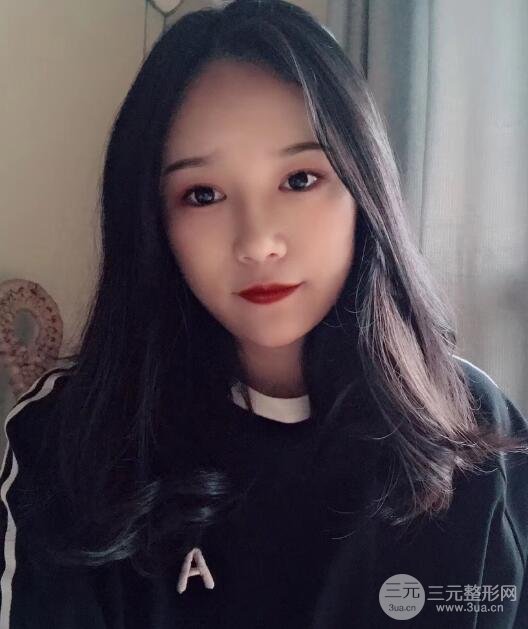 丰太阳穴手术后