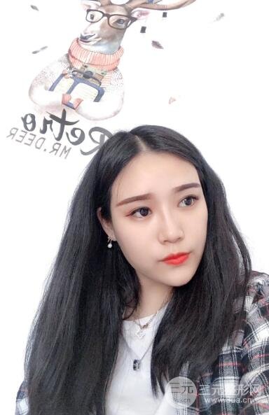 丰太阳穴手术后