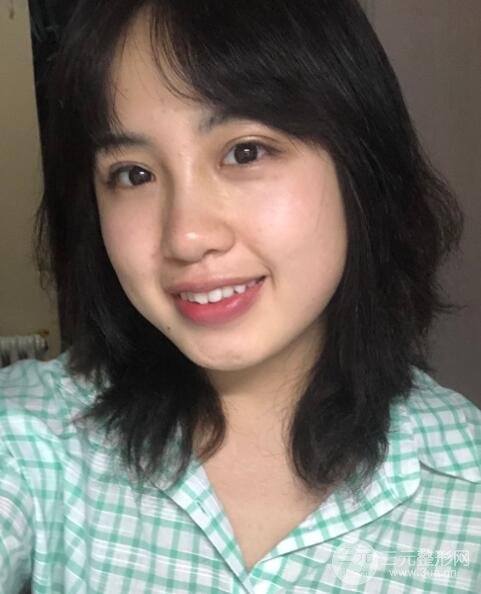 耳软骨垫鼻尖失败手术时