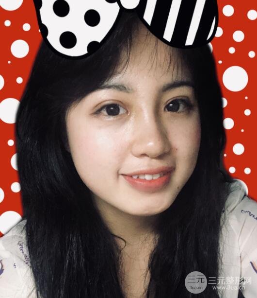 耳软骨垫鼻尖失败手术后